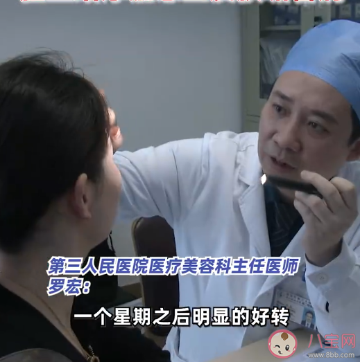 女子為護膚1個月不洗臉致滿臉結(jié)痂 長時間不洗臉會怎樣