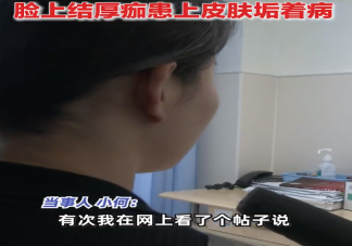 女子為護(hù)膚1個(gè)月不洗臉致滿臉結(jié)痂 長(zhǎng)時(shí)間不洗臉會(huì)怎樣