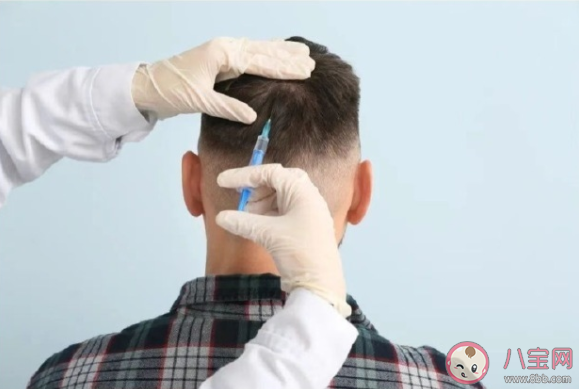 為什么有人禿頭但腿毛特長(zhǎng) 腿毛可以移植到頭上嗎